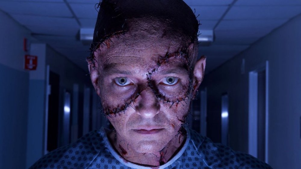 A man with severe facial scarring. 