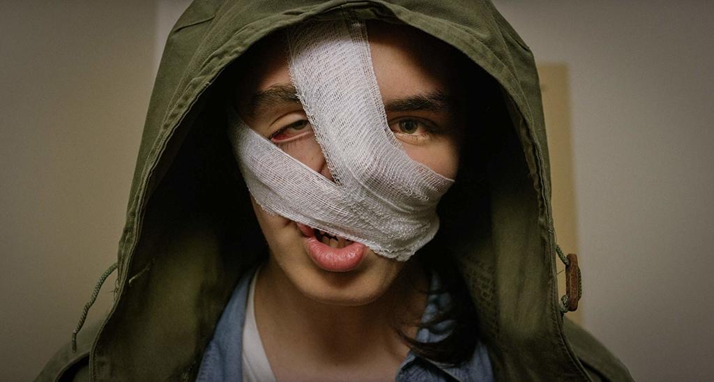 Stan (Robin L'Houmeau) with his face wrapped up in bandages.