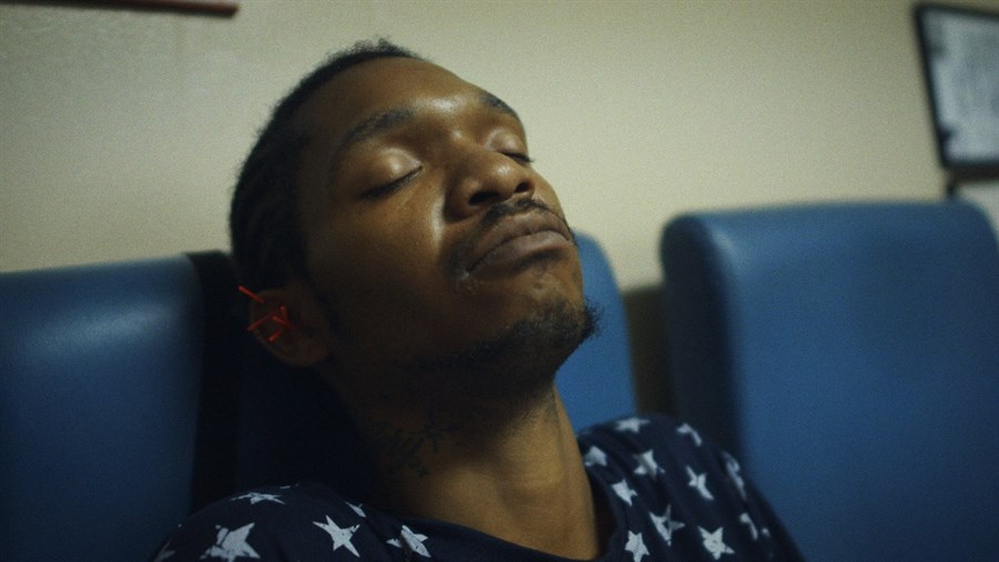 A Black man relaxing with acupuncture needles in his ear.