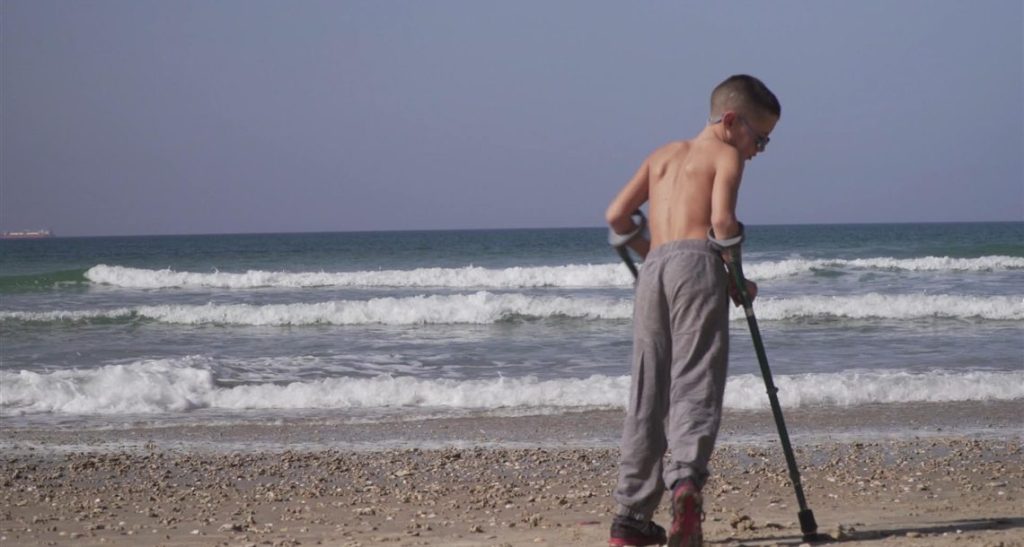 Ron walking on the beach with crutches.