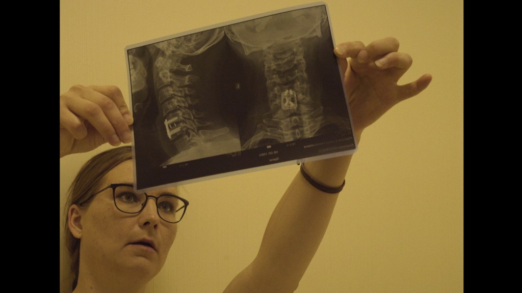 Helene holding up an x-ray of her spine.